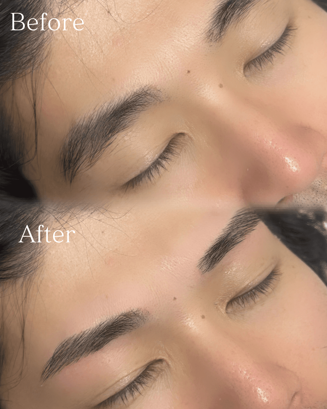 施術例3 Before/After