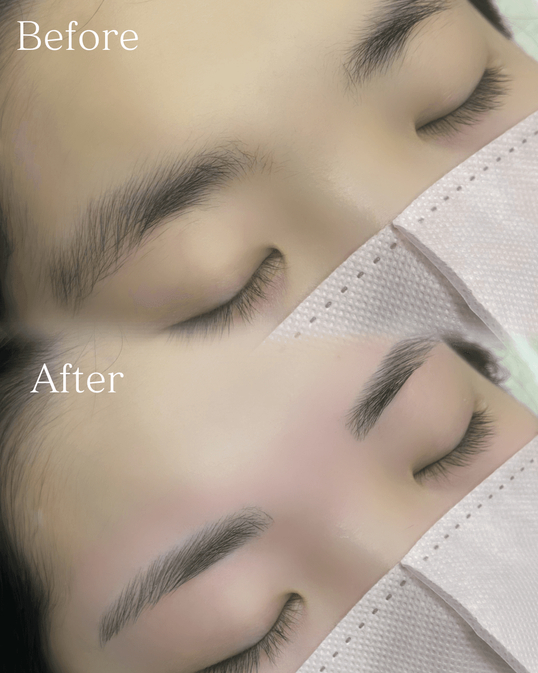 施術例2 Before/After