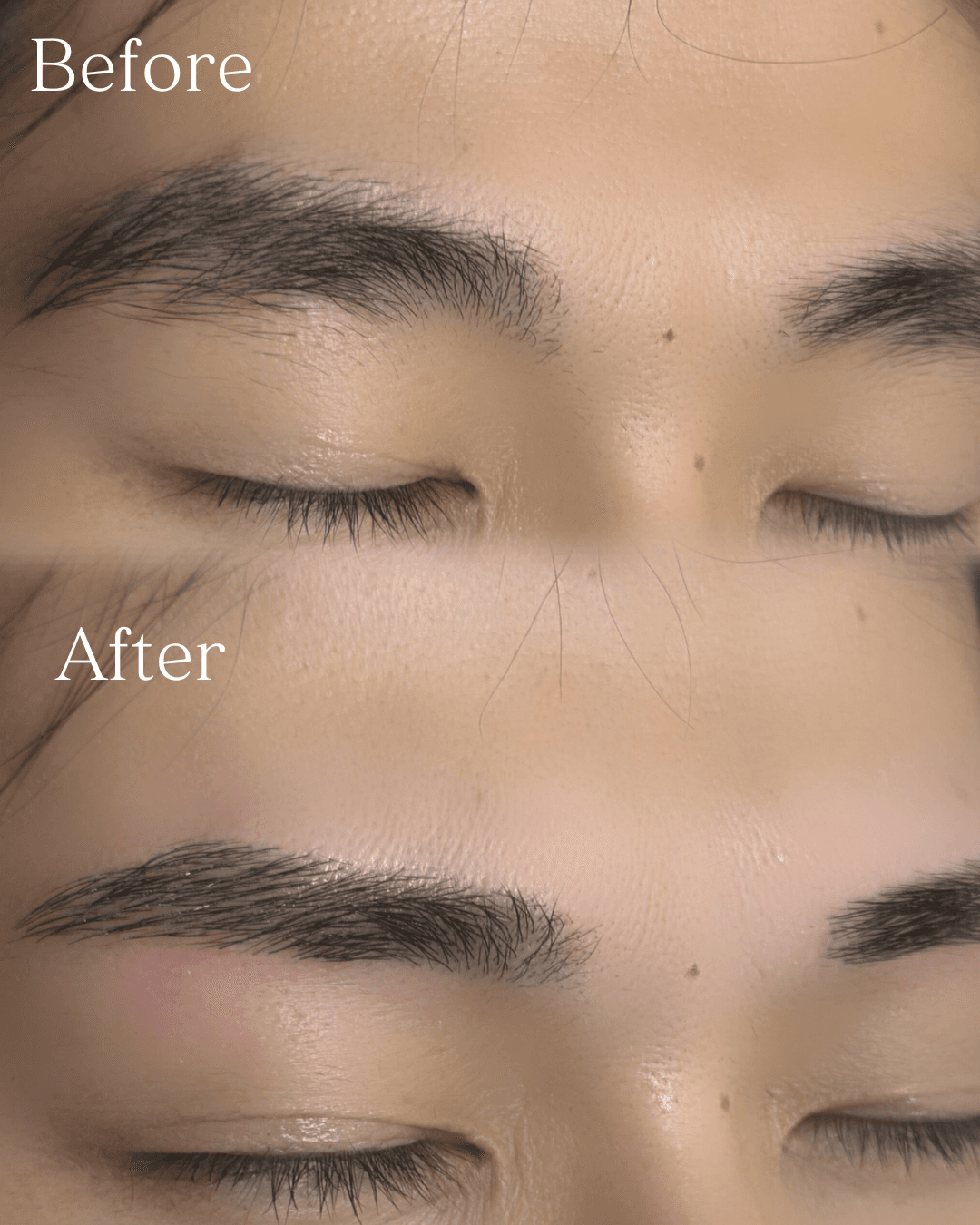 施術例3 Before/After